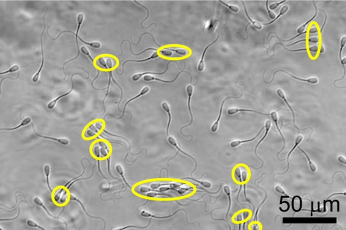 Proč bičík spermií ignoruje Newtonův zákon (Ušetříte energii) - image 1