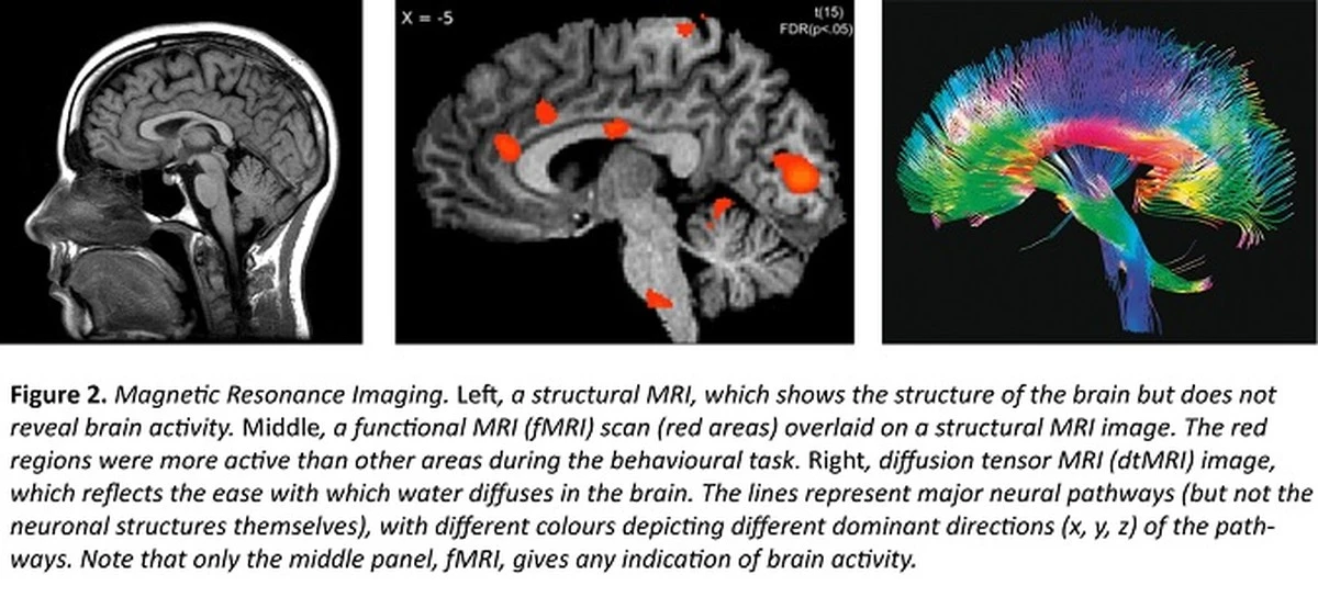 Proč se ženský mozek mění rychleji: Protein spojený s Parkinsonem vysvětluje riziko Alzheimerovy nemoci - image 1