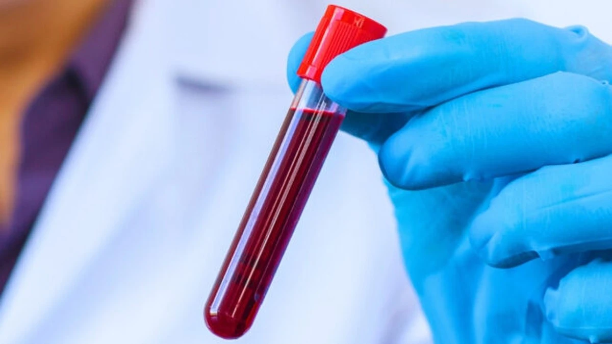 Proč krev stoletých lidí vypadá jinak: Vědci našli 37 proteinů, které brzdí stárnutí - image 1