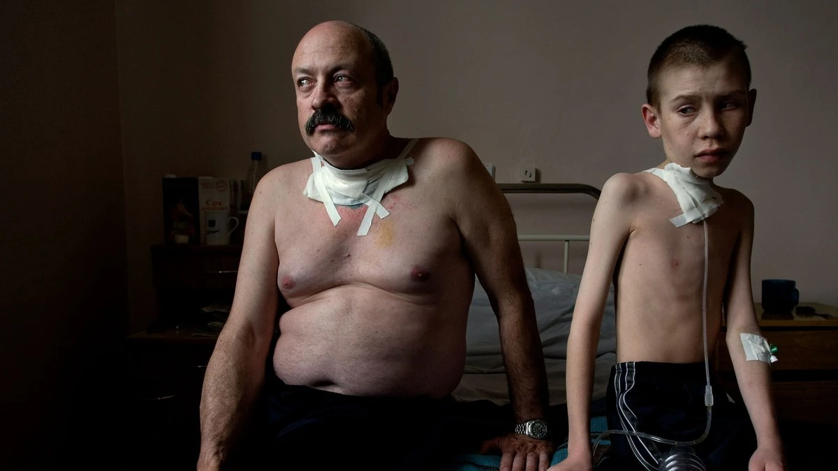 Proč děti otců z Černobylu nesou v DNA zvláštní shluky: Vědci potvrdili transgenerační změny - image 1