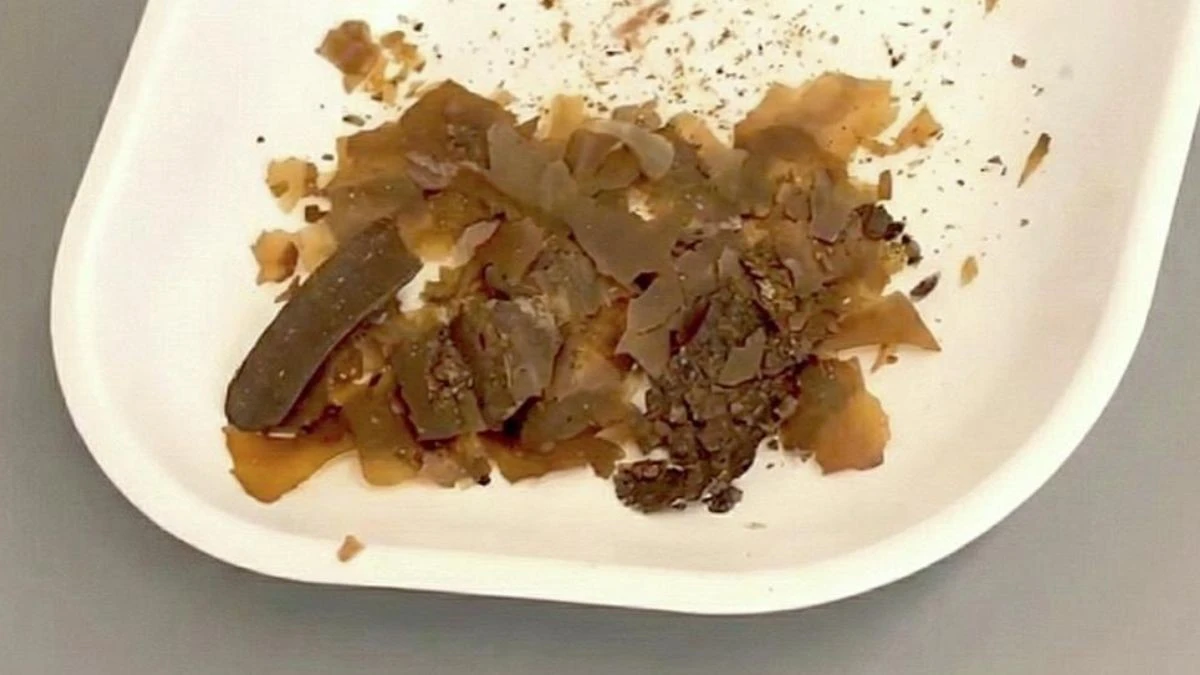 Římský recept na zdraví: Proč v lahvičkách z 2. století našli výkaly