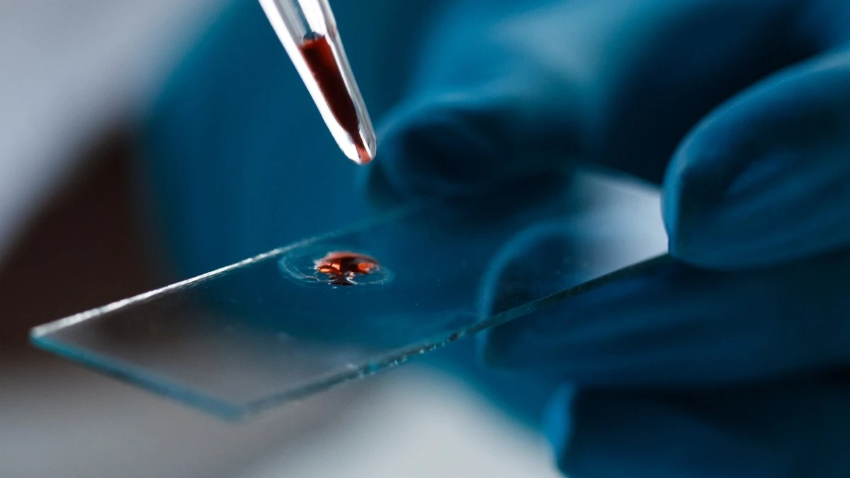 Proč vědci nyní hledají protein p-tau217 v krvi žen už po čtyřicítce